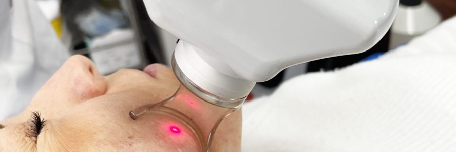 Laser CO2 / Laser Erbium,Fotoringiovanimento