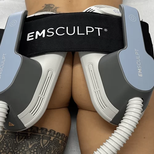 EmSculpt